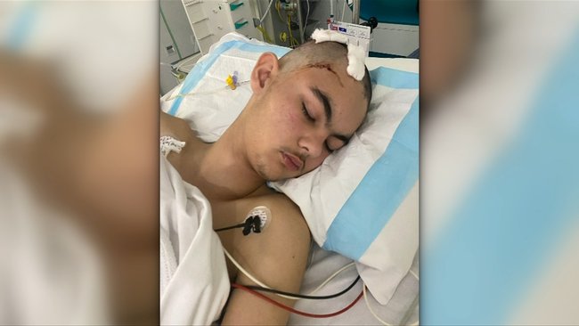 Teen Rudolf Oosthuizen has had emergency surgery to remove a mass on his brain.